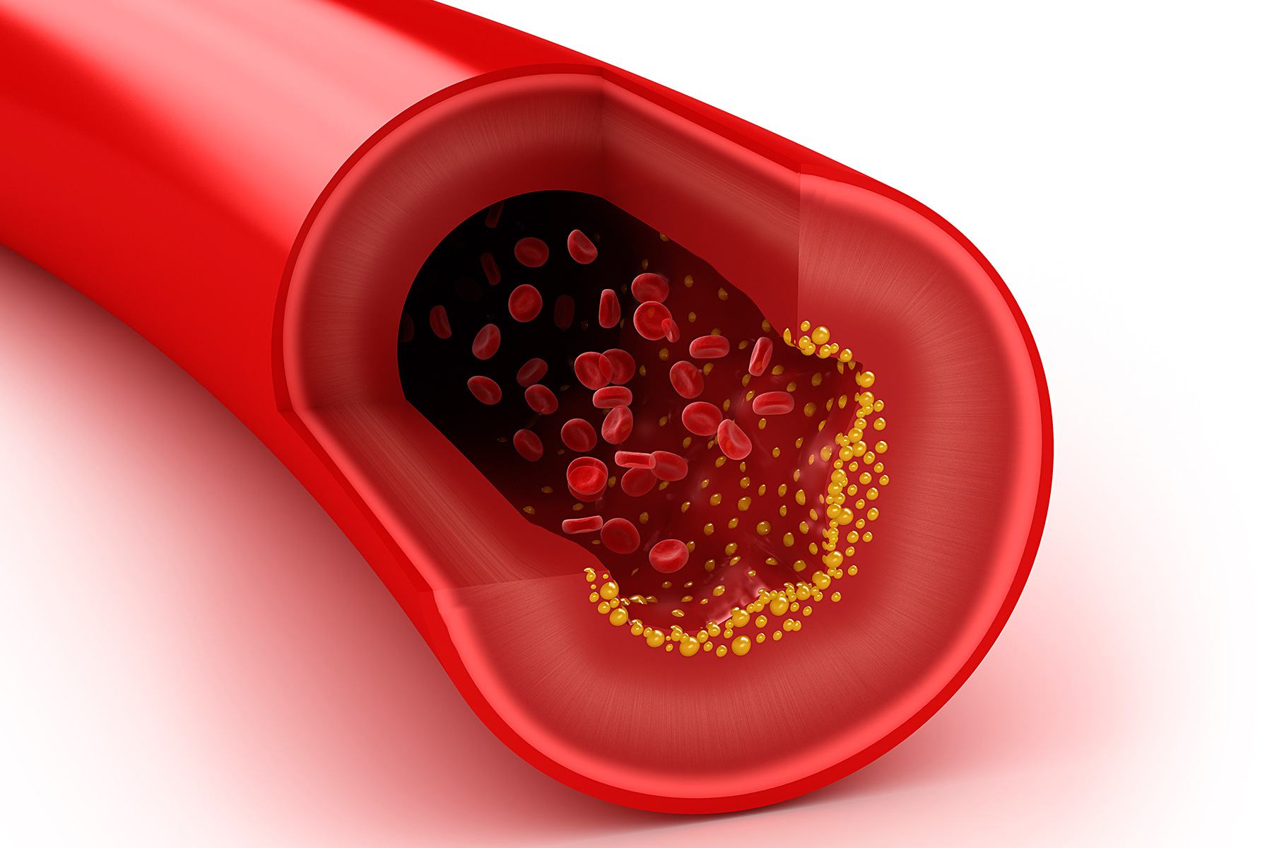 What Is Considered Dangerous Level Of Cholesterol